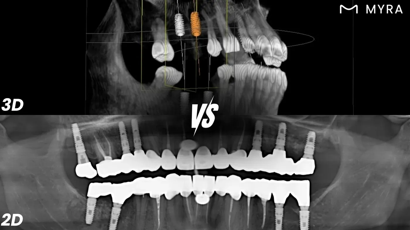 2d-vs-3d-dis-goruntuleme.webp