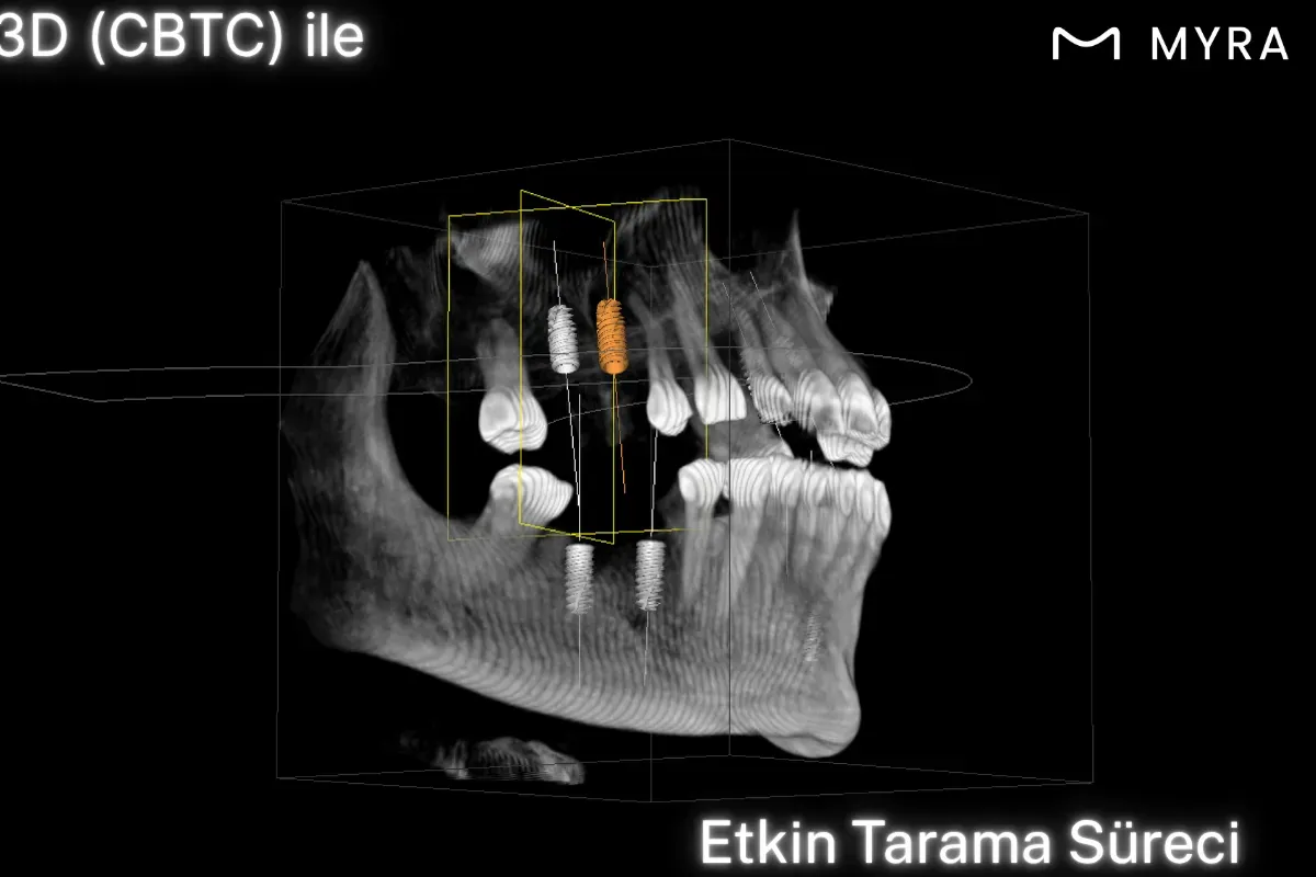 3D çene tarama sistemiyle yapay zeka destekli implant planlaması