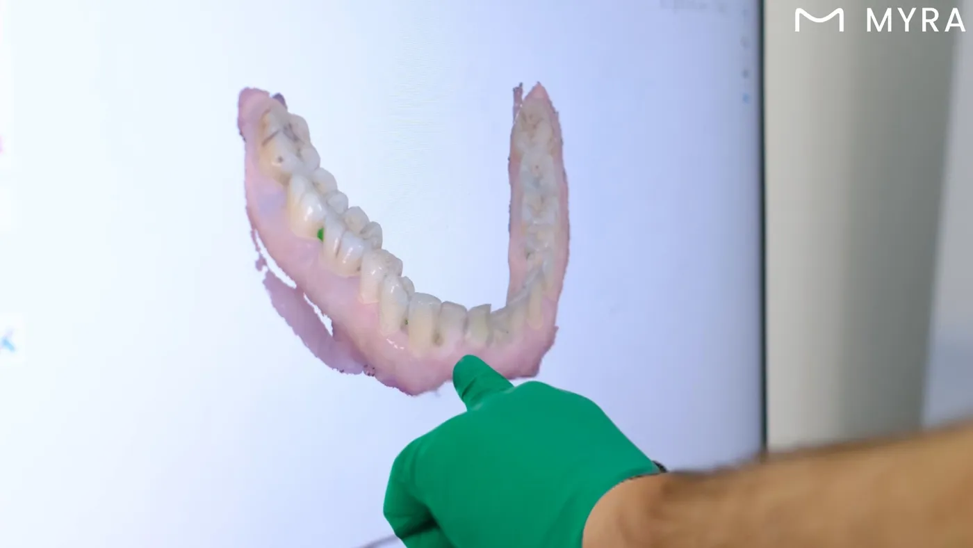 Diş hekimi elinde 3D tarama sonucu oluşan alt çene modelini gösteriyor