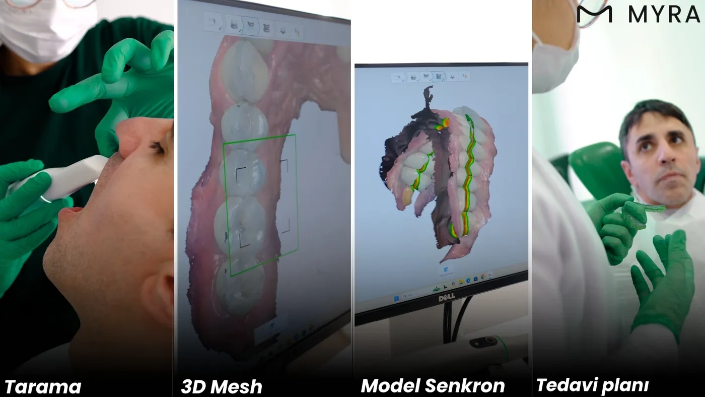 3D tarama sonuçlarının iki ayrı ekranda tedavi planlamasında kullanımı