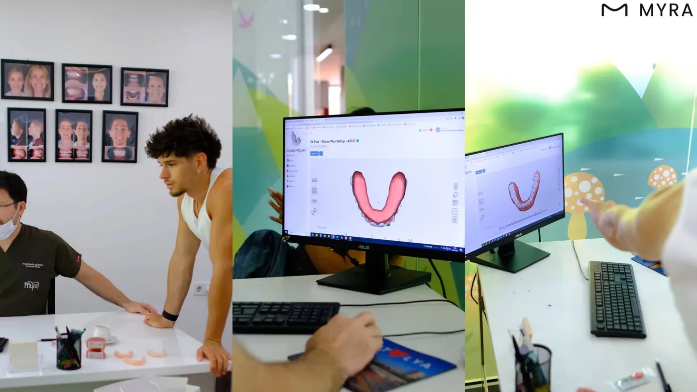 Bilgisayar ekranında şeffaf plak tedavisi için dijital aligner simülasyonu