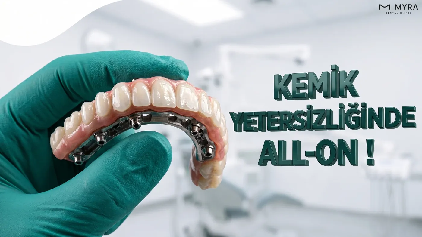 Kemik yetersizliğinde uygulanan All-on-4 sistemi