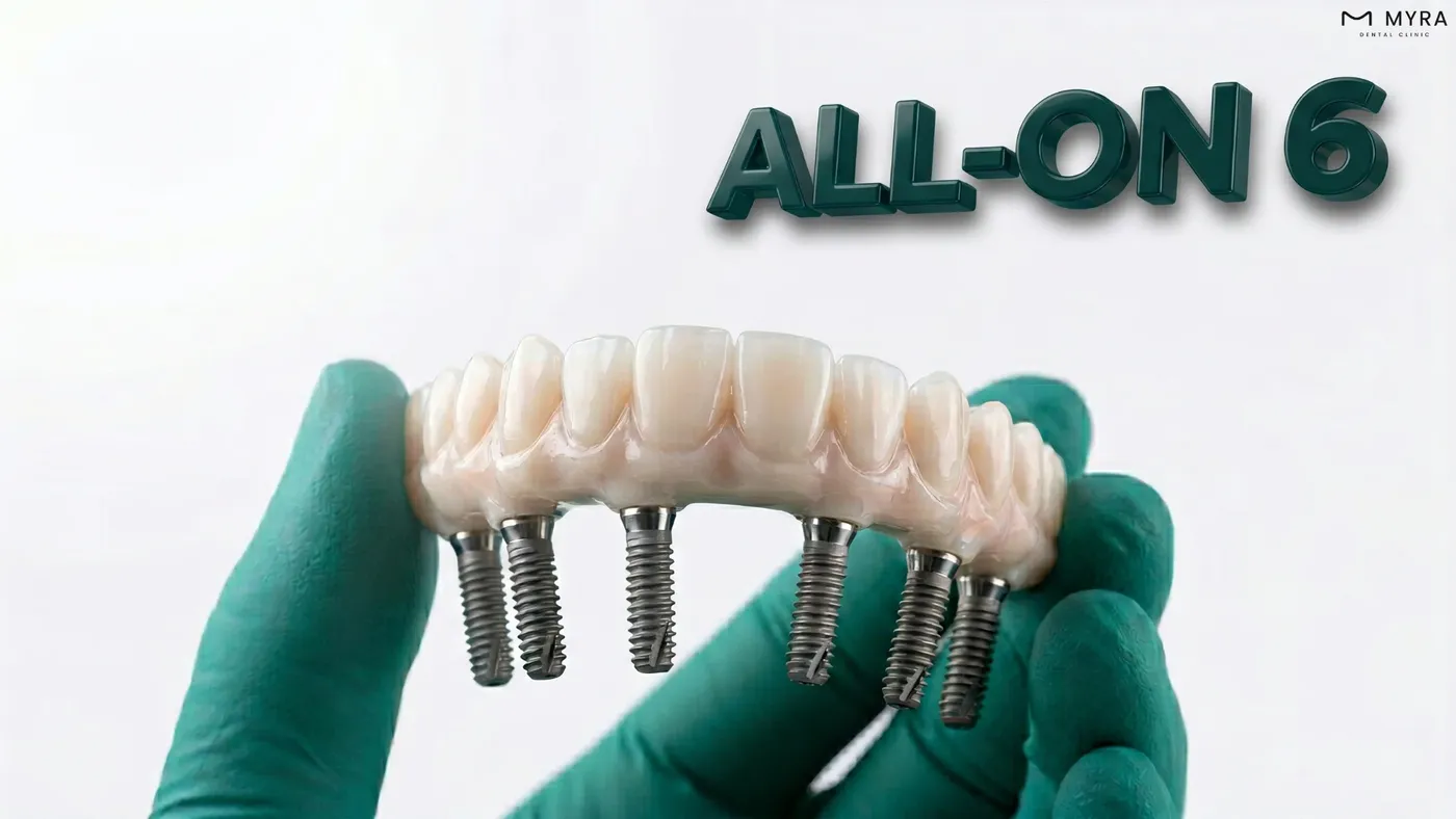 Çene kemiğine yerleştirilen 6 implant üzerine sabit protez