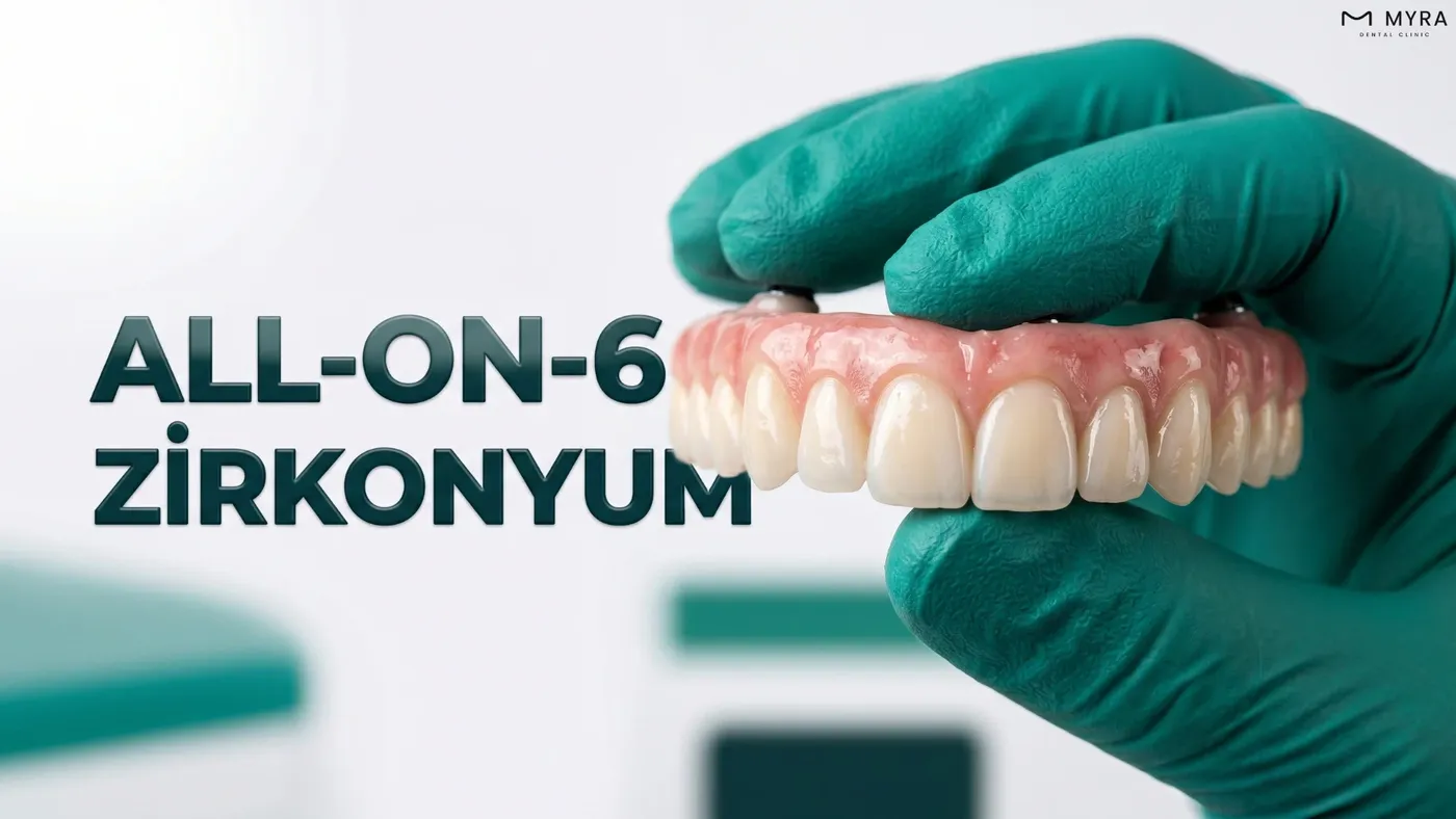 Zirkonyum sabit protez ile tamamlanmış All-on-6 tedavisi