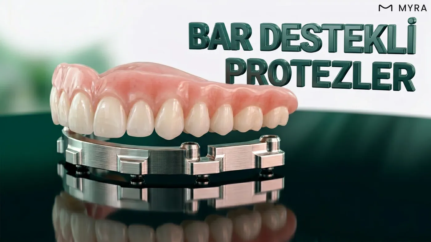 Bar bağlantısı üzerine oturan implant destekli protez sistemi