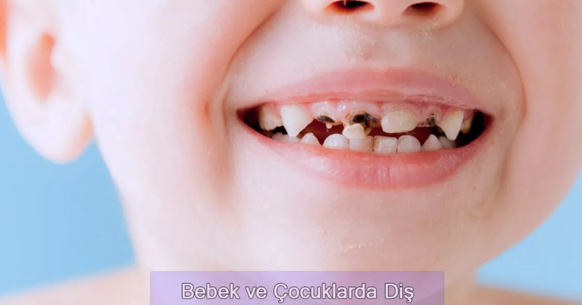 https://www.myradental.com/api/media/file/bebek-ve-cocuklarda-dis-curugu-belirtileri-1200x630.webp