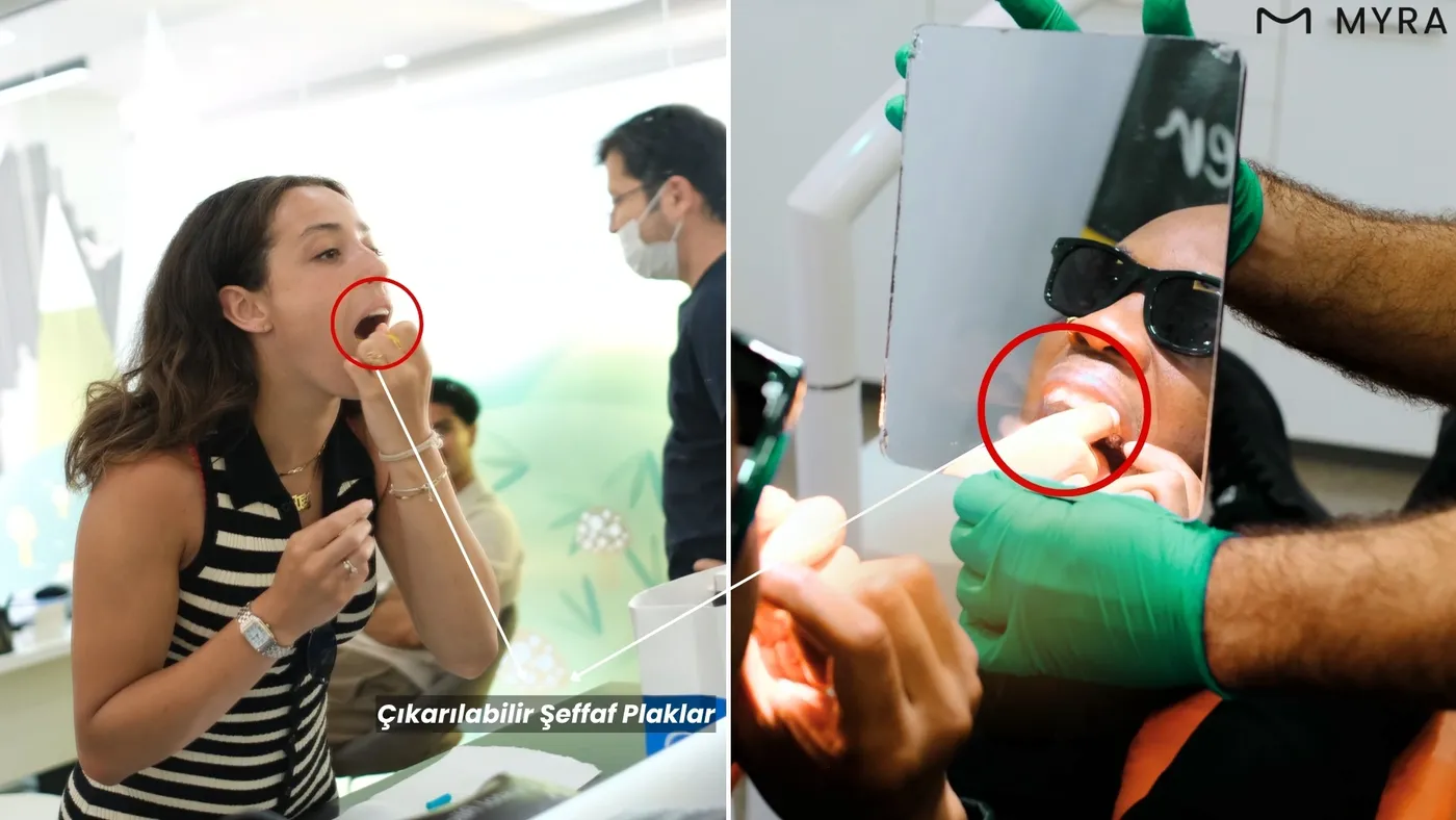 Şeffaf plaklarını ellerinde tutan yetişkin kişi – çıkarılabilir yapının vurgulandığı görsel
