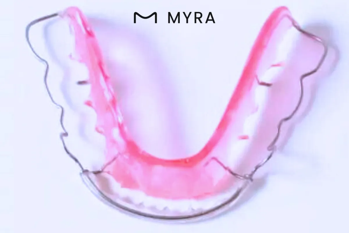 Ortodonti sonrası kullanılan pembe retainer plakÇocuklarda Retainer Kullanımı
