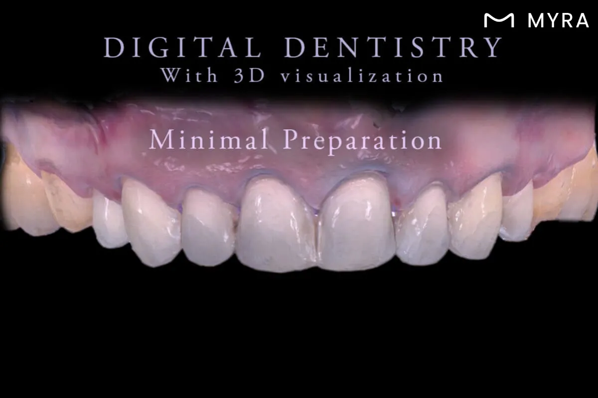 3D Tarama ile Dijital Diş Modelleme