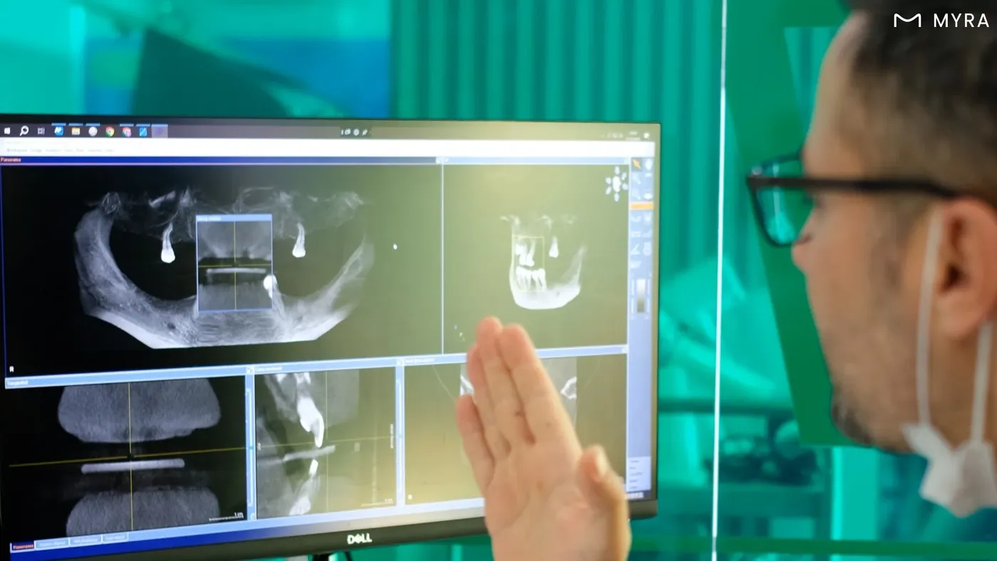 Antalya Myra Dental’de dikişsiz implant öncesi hasta muayenesi ve dijital değerlendirme süreci