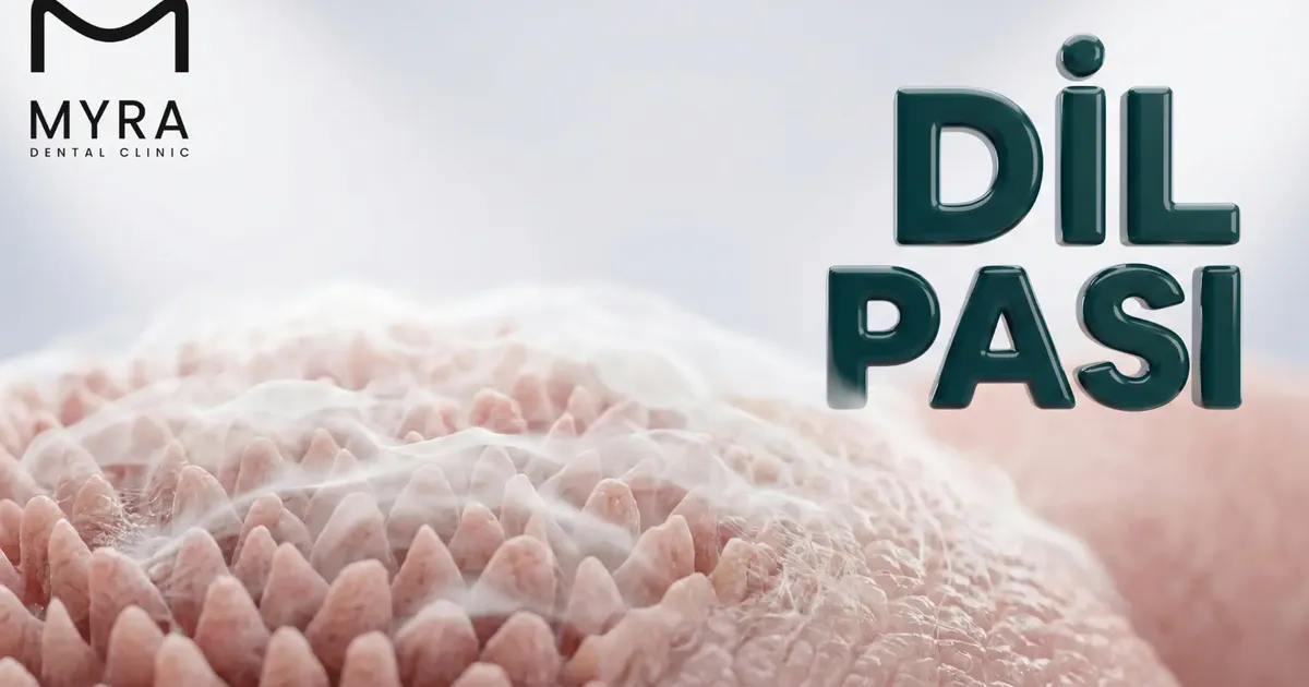 Dil Pası Neden Oluşur? Dil Beyazlaması ve Sarı Dil | Myra | Myra Dental