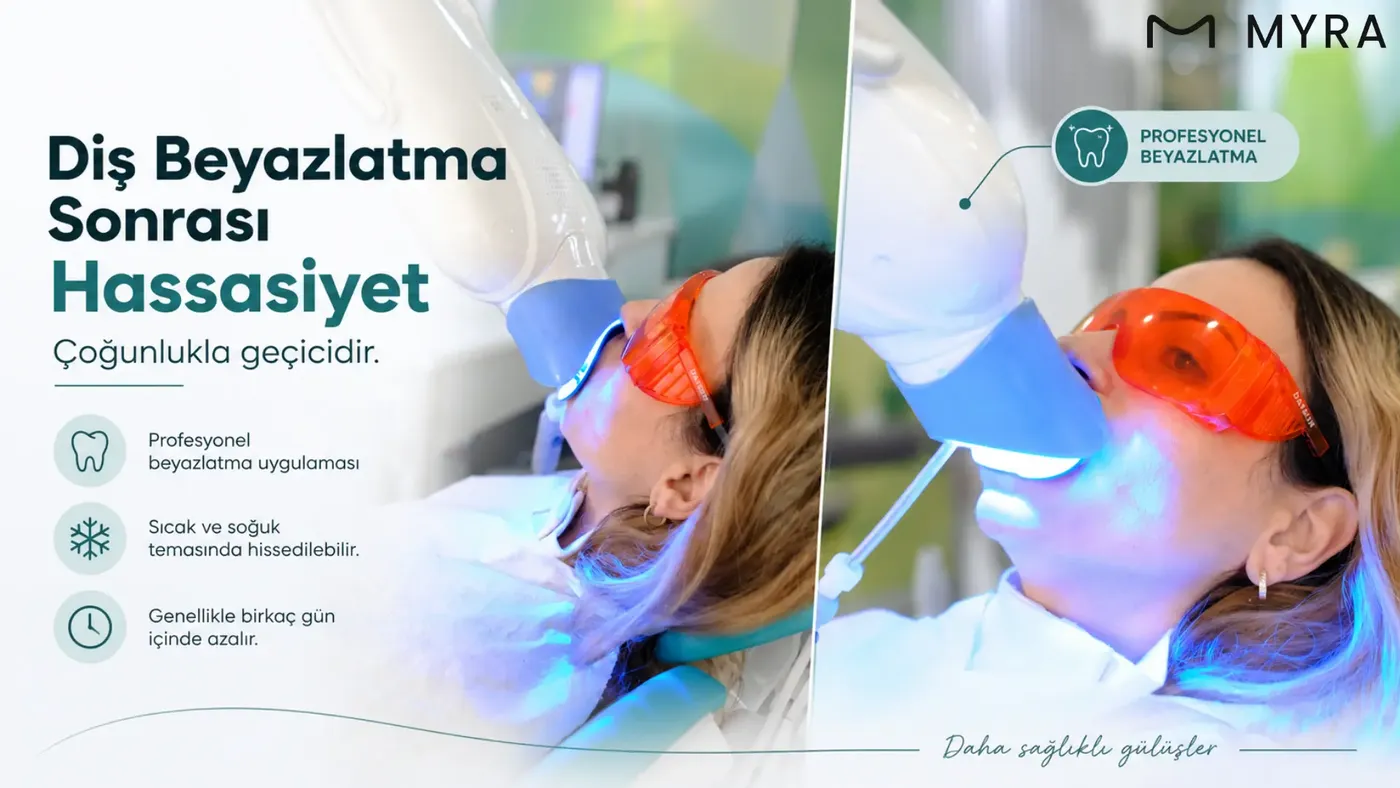 Diş beyazlatma sonrası hassasiyet ne kadar sürer