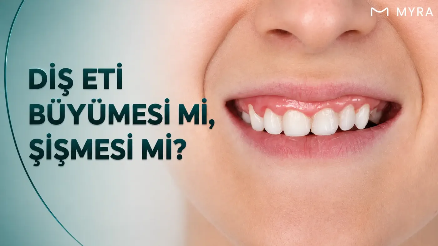 dis-eti-buyumesi-ve-dis-eti-sismesi-farki.webp