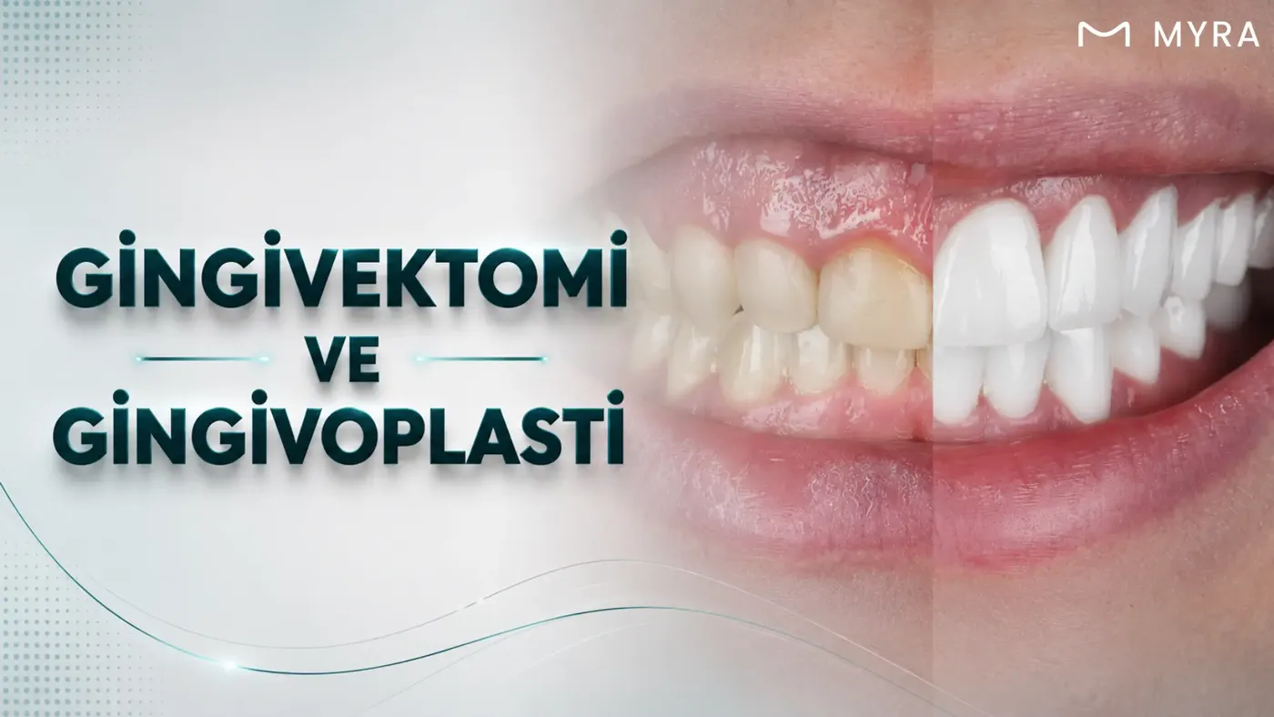 dis-eti-buyumesinde-gingivektomi-ve-gingivoplasti.webp