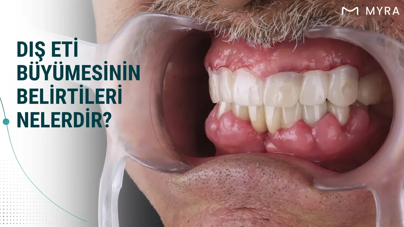 dis-eti-buyumesinin-belirtileri.webp