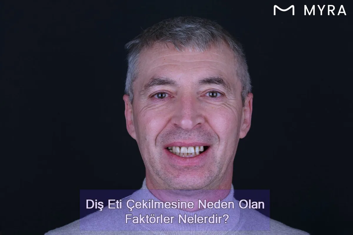  Diş eti çekilmesi 