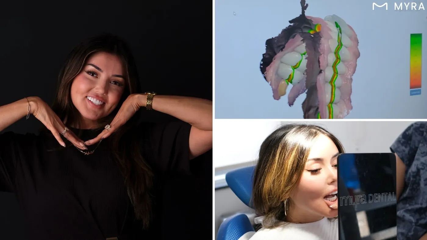 Gülüş tasarımı prova uygulaması