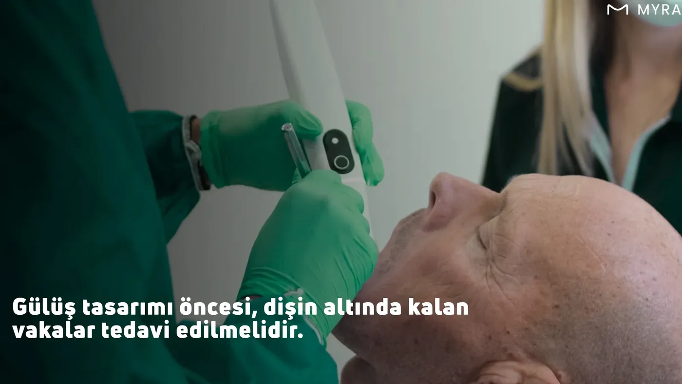 Gülüş tasarımı öncesi diş ve diş eti sağlığı kontrolü