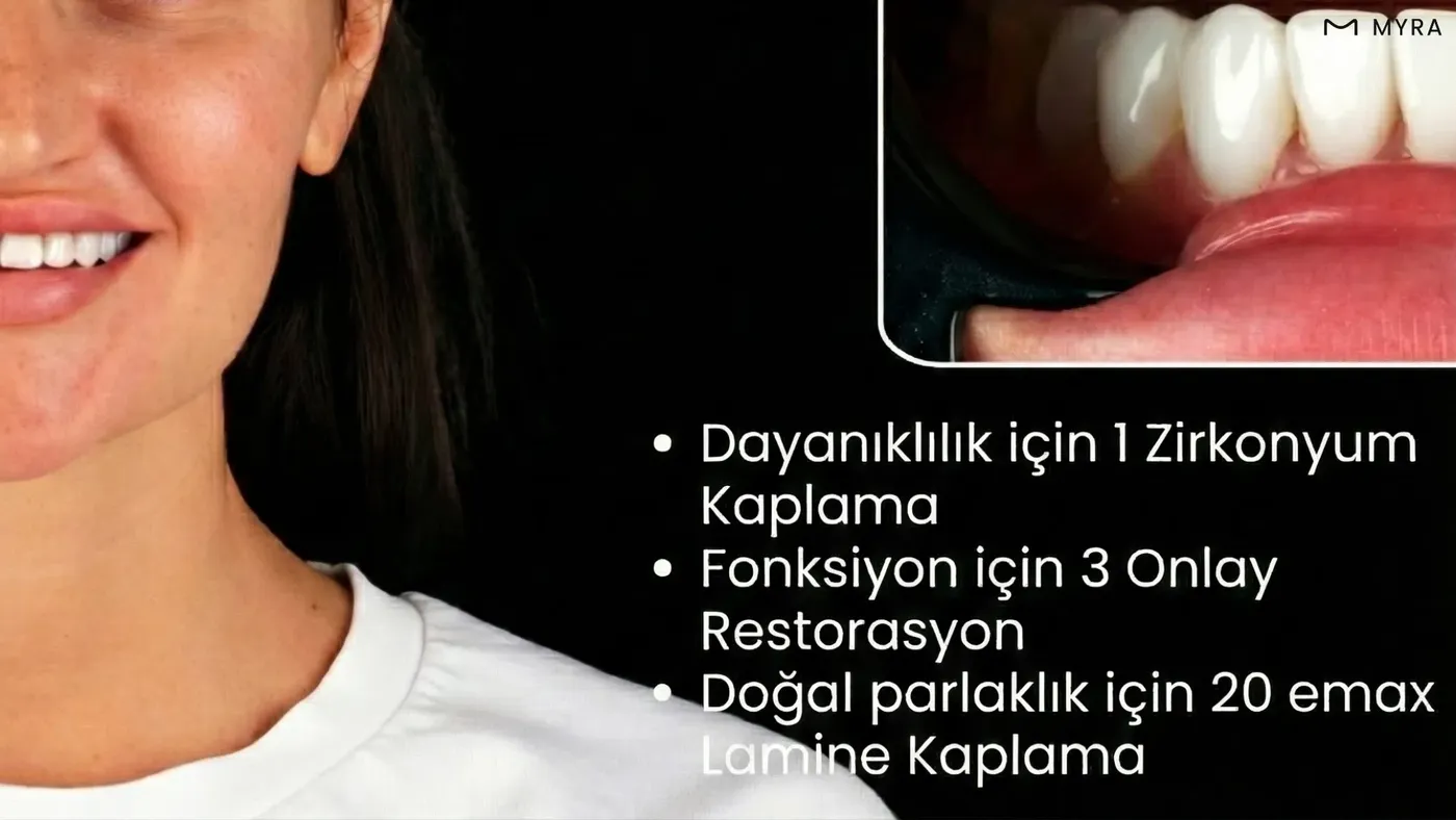 Ön bölgede Emax kaplama, arka bölgede zirkonyum kaplama uygulamasını gösteren dental şema