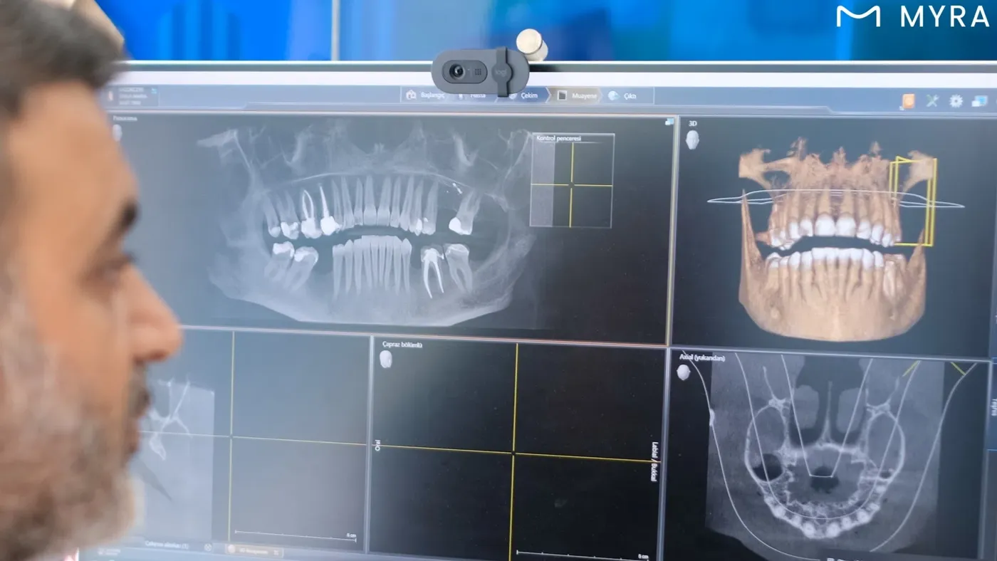 implant-3d-planlama.webp