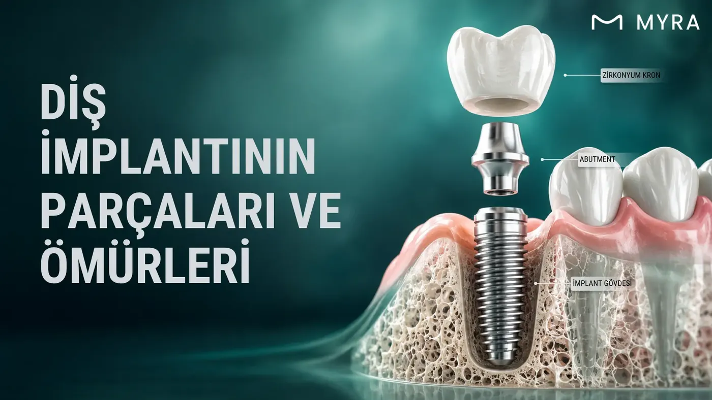 Dental implant gövdesi, abutment ve implant üstü kron parçalarının anatomik gösterimi