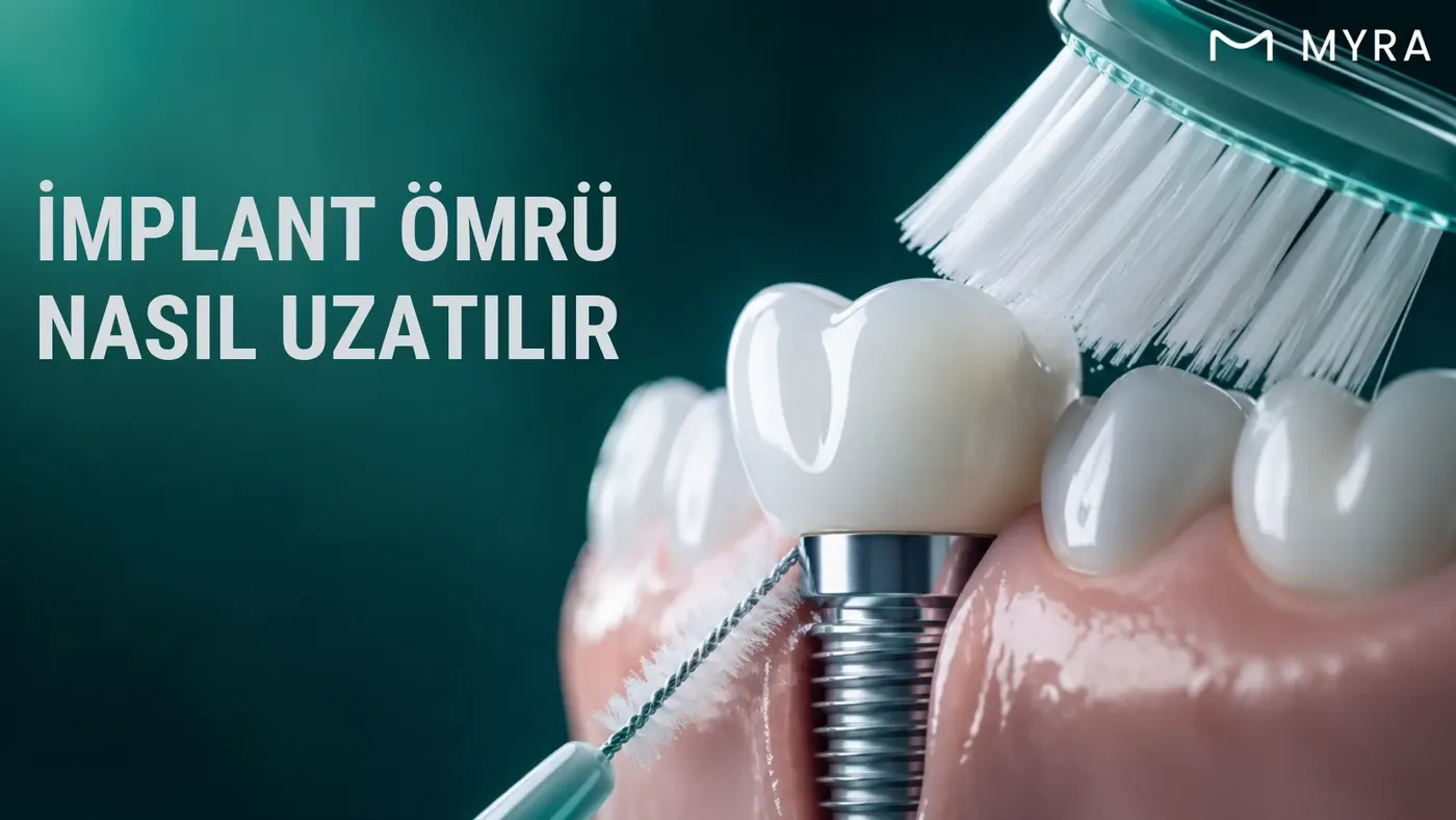 İmplant çevresinin diş fırçası ve arayüz fırçası kullanılarak temizlenmesi