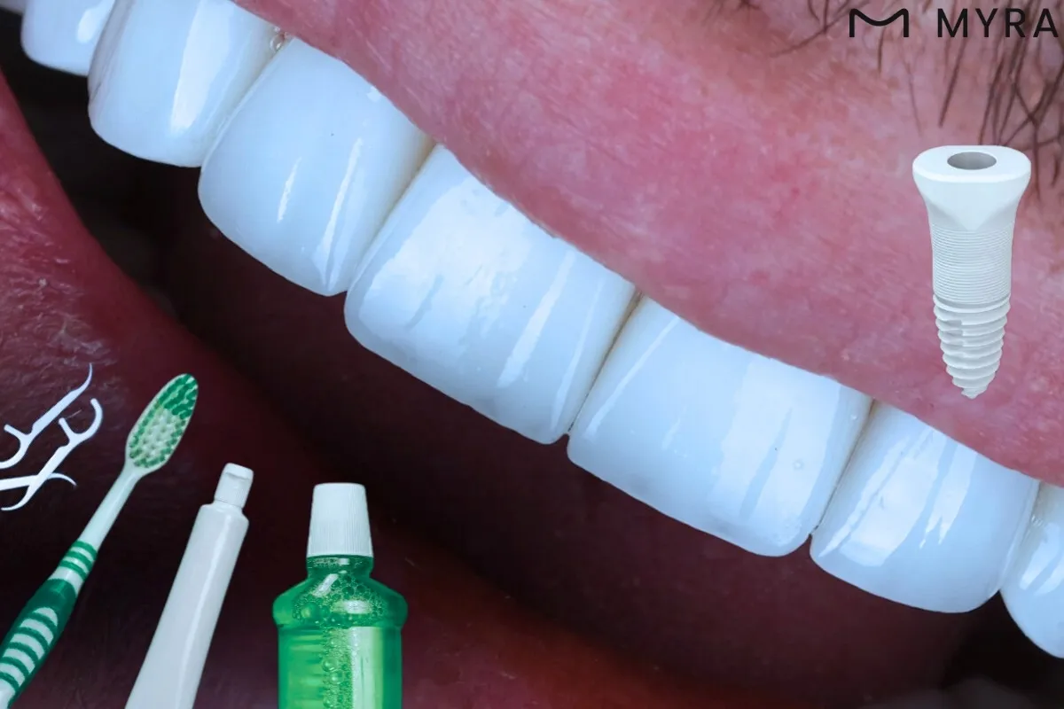 Diş İmplantı Nasıl Yapılır? 6 Adımda İmplant Tedavi Süreci | Myra Dental