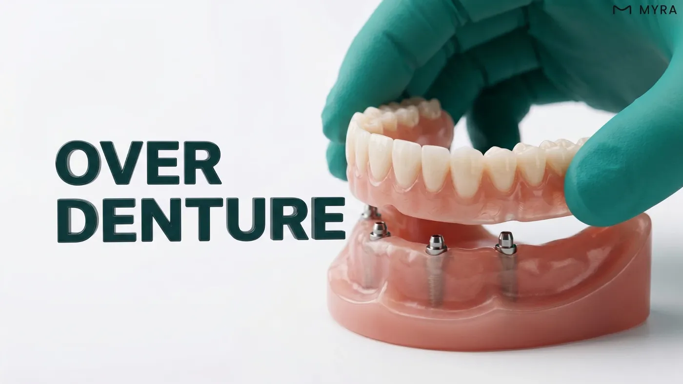 Çeneye yerleştirilen mini implantlar üzerine oturan implant üstü protez modeli 
