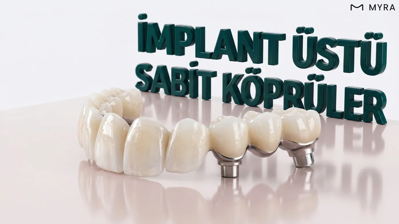 Birden fazla eksik dişi tamamlayan implant destekli sabit köprü