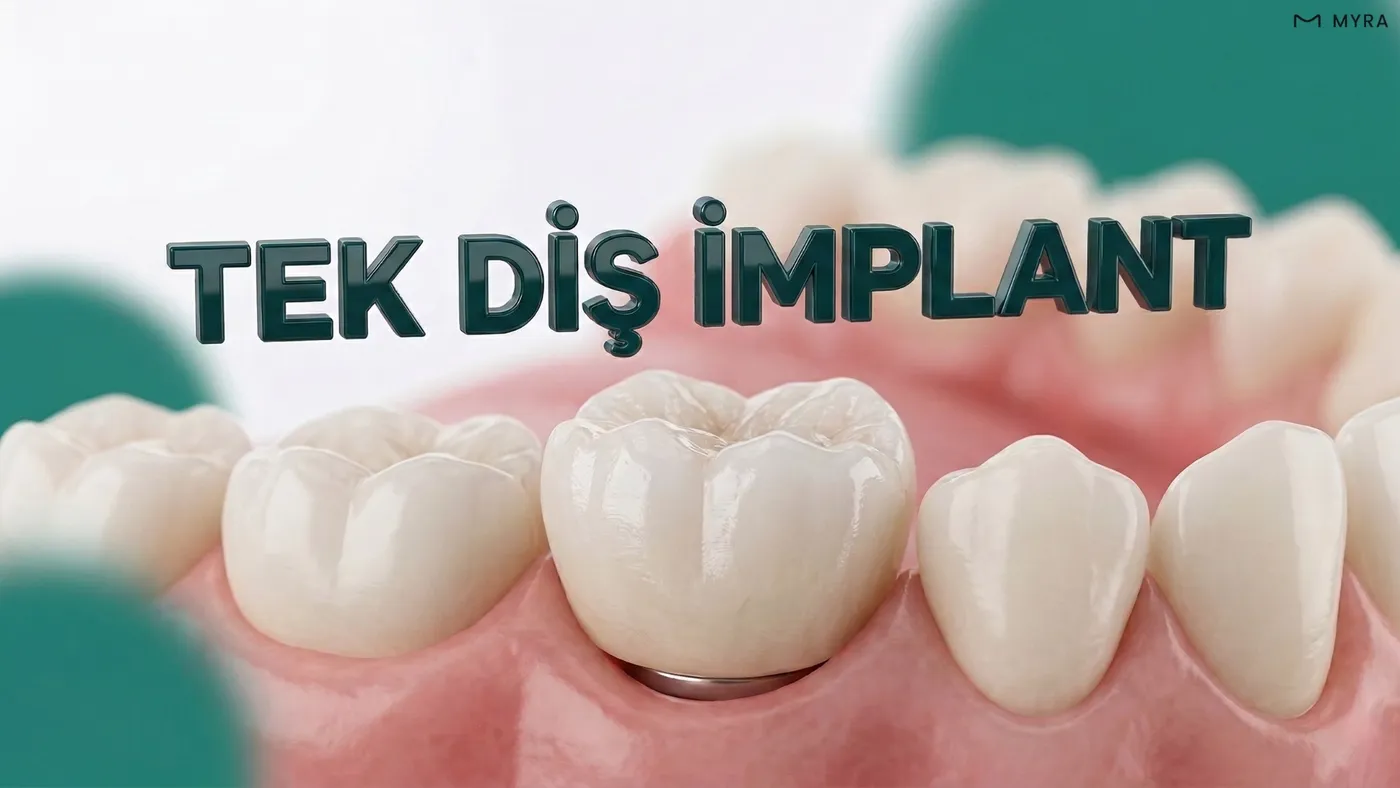 Çene kemiğine yerleştirilmiş implant üzerine yapılmış porselen kron