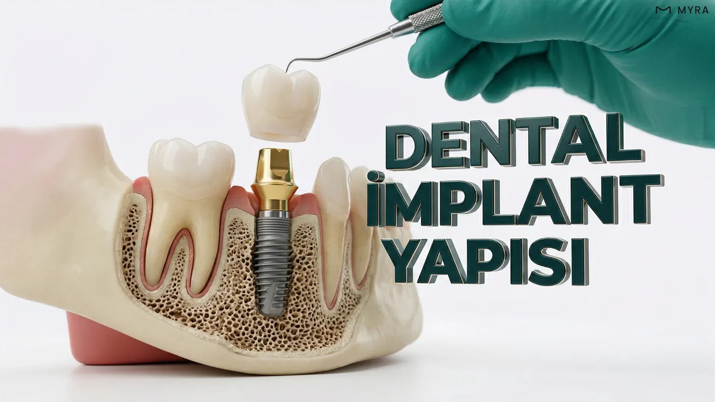 Çene kemiğine yerleştirilen implant ve üzerine yapılan diş kaplaması