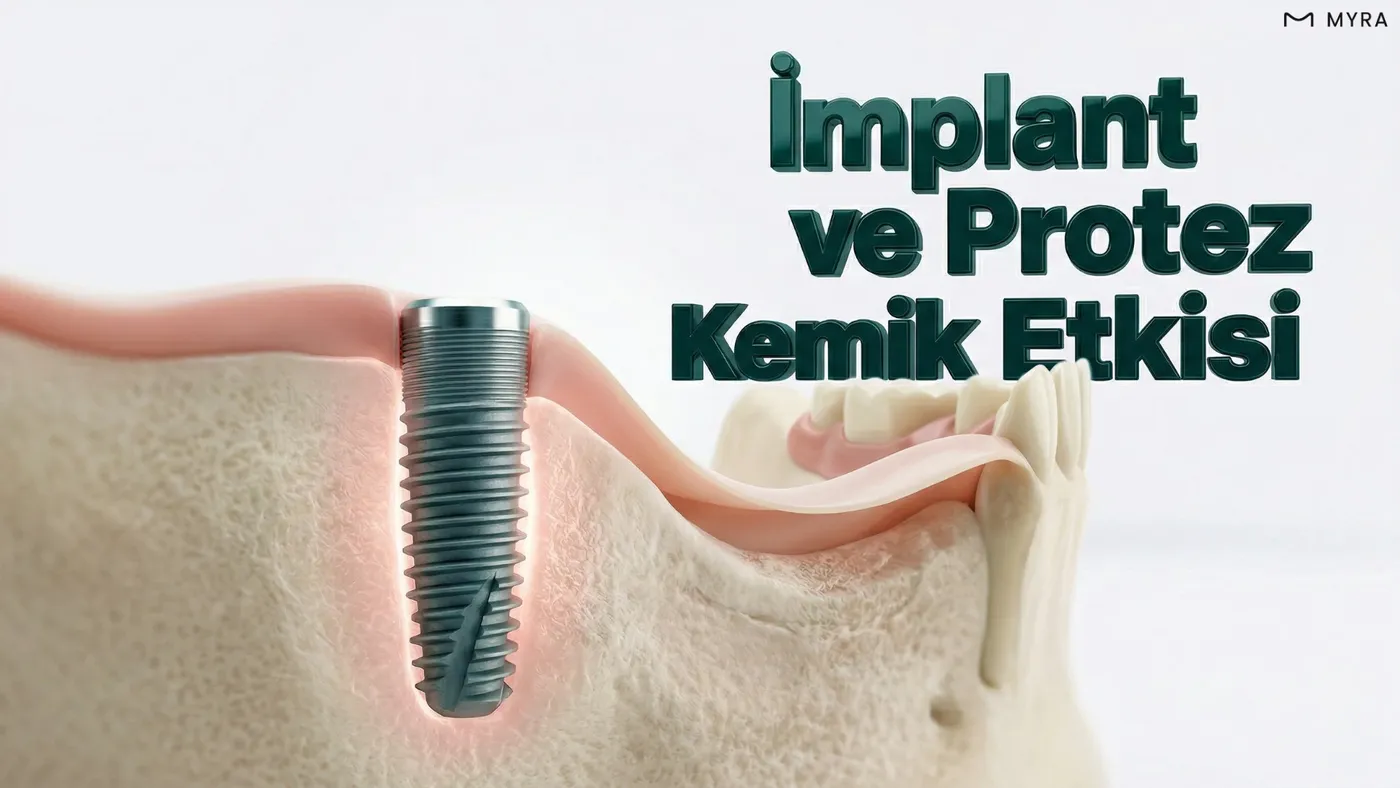 İmplantın kemik koruyucu etkisi ve protezde kemik kaybı karşılaştırması
