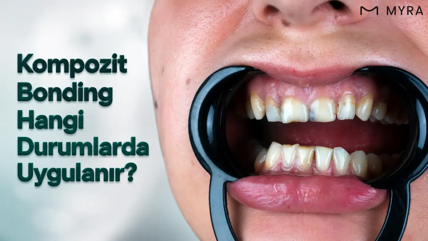 Diş arası boşluk, kırık ön diş, aşınmış kesici kenar ve şekil bozukluğu örnekleri
