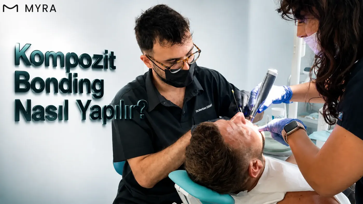 Kompozit bonding uygulamasının renk seçimi, uygulama, ışıkla sertleştirme ve cila aşamalarını gösteren illüstrasyon