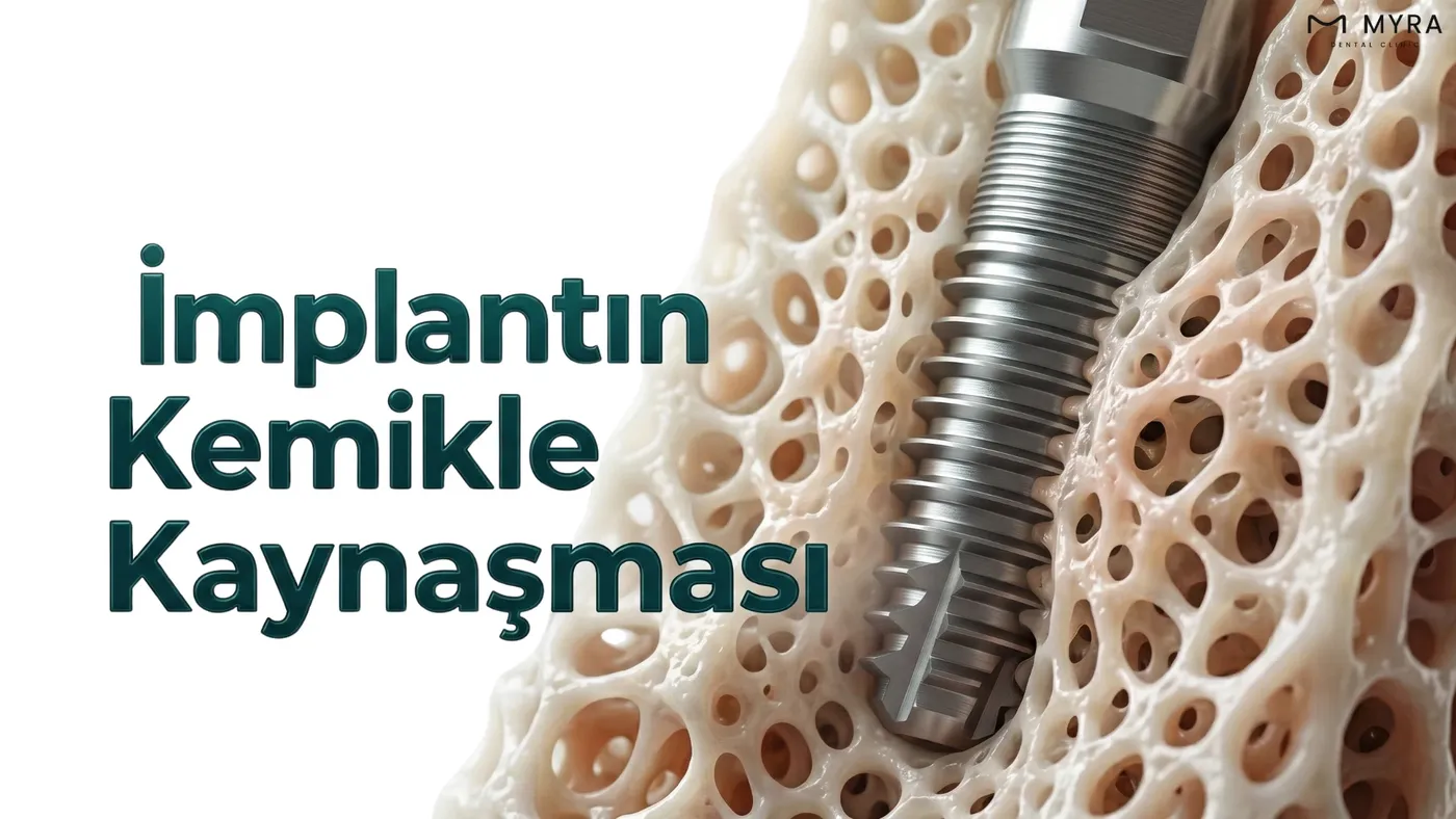 İmplant çevresinde kemik oluşumu