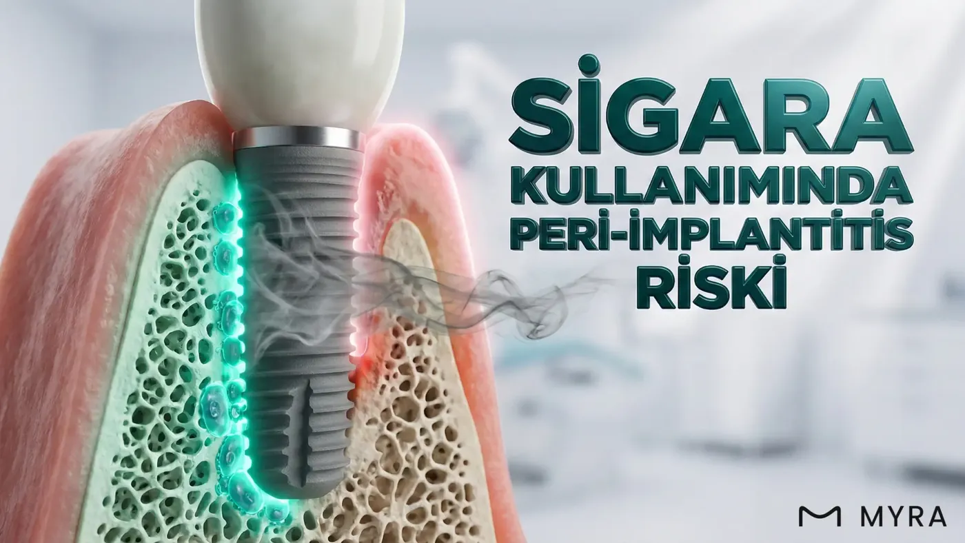 İmplant çevresinde kemik kaybı ve iltihaplanmayı gösteren dental röntgen görüntüsü