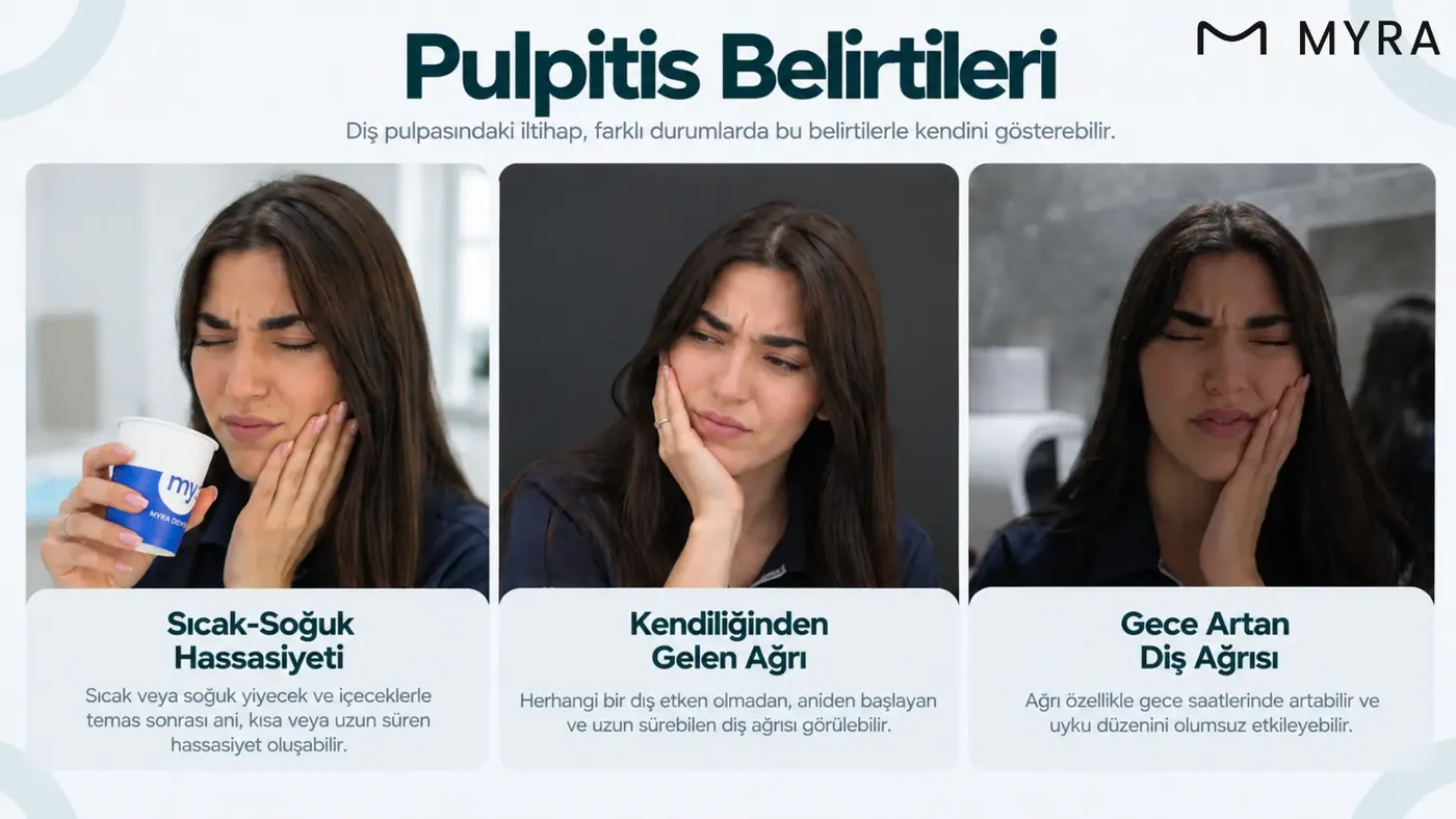 Sıcak soğuk hassasiyeti, kendiliğinden gelen ağrı ve gece artan diş ağrısı gibi pulpitis belirtilerini gösteren görsel