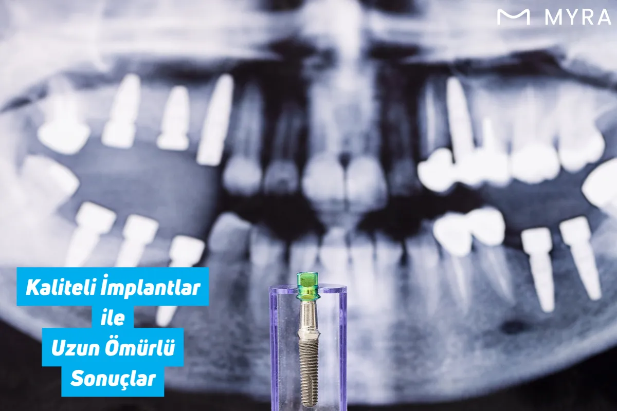 Periimplantitis teşhisi için alınmış dental panoramik film