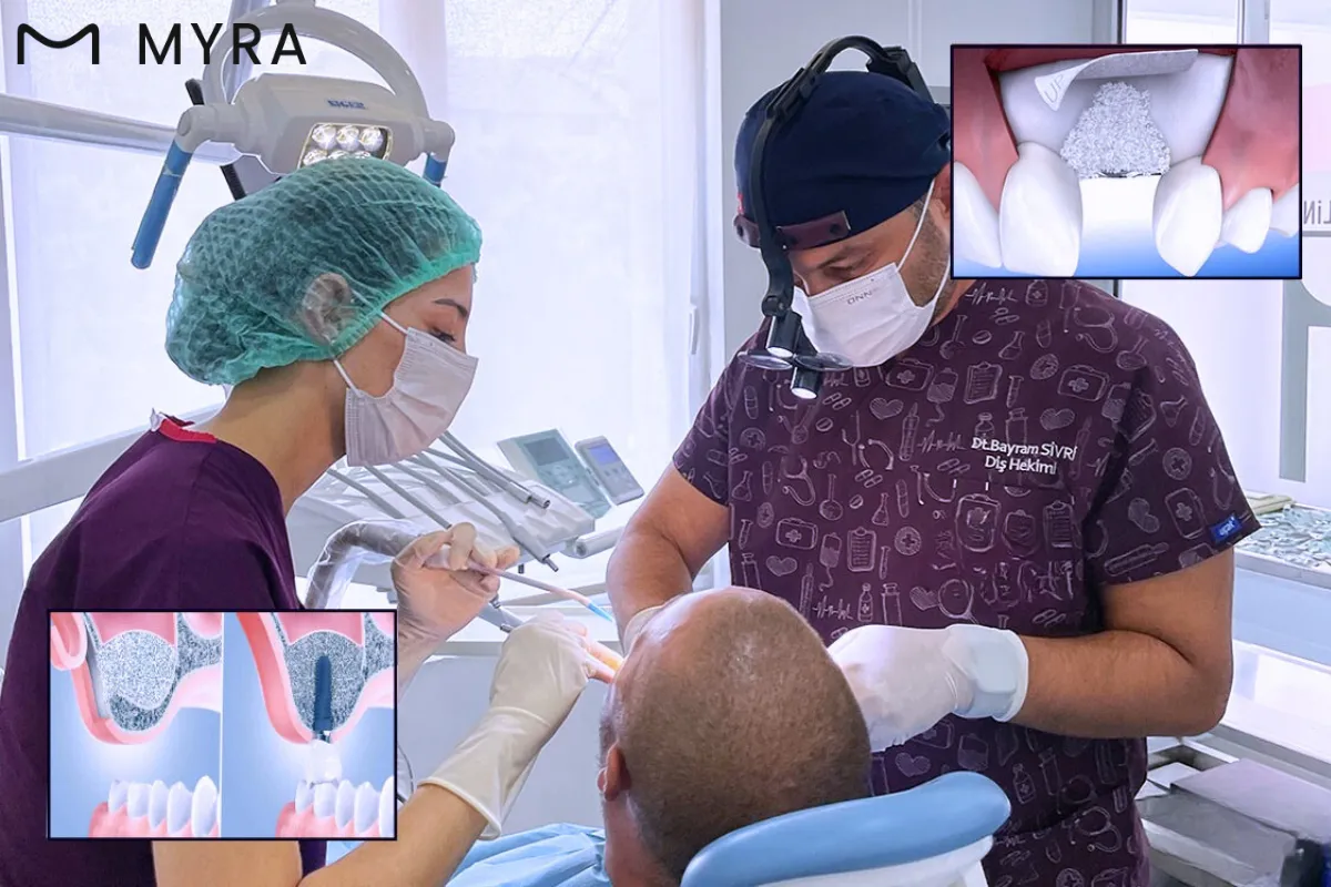 sinus-tabani-yukseltme-operasyonu.webp