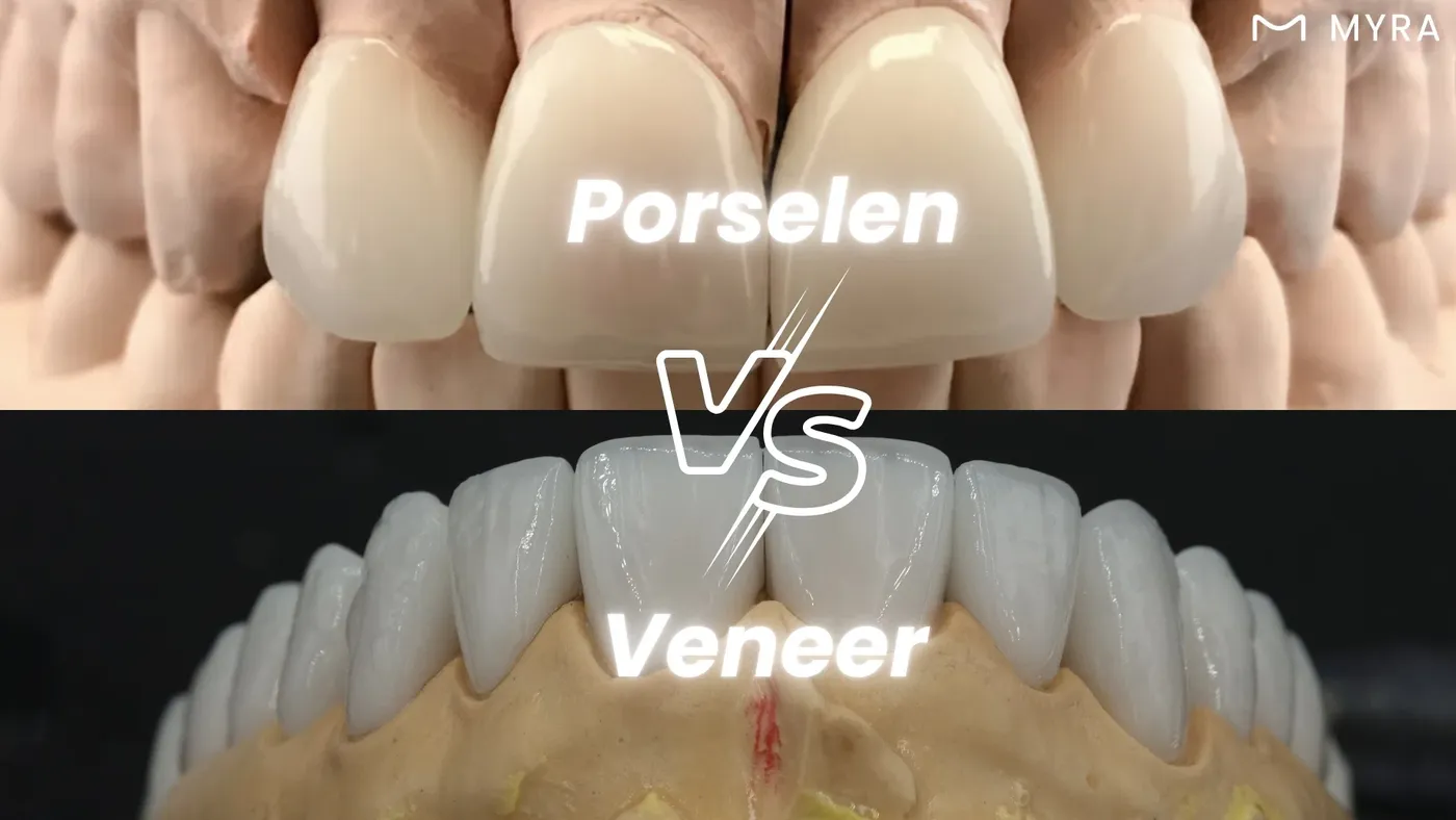 Porselen veneer ile porselen kron farkı