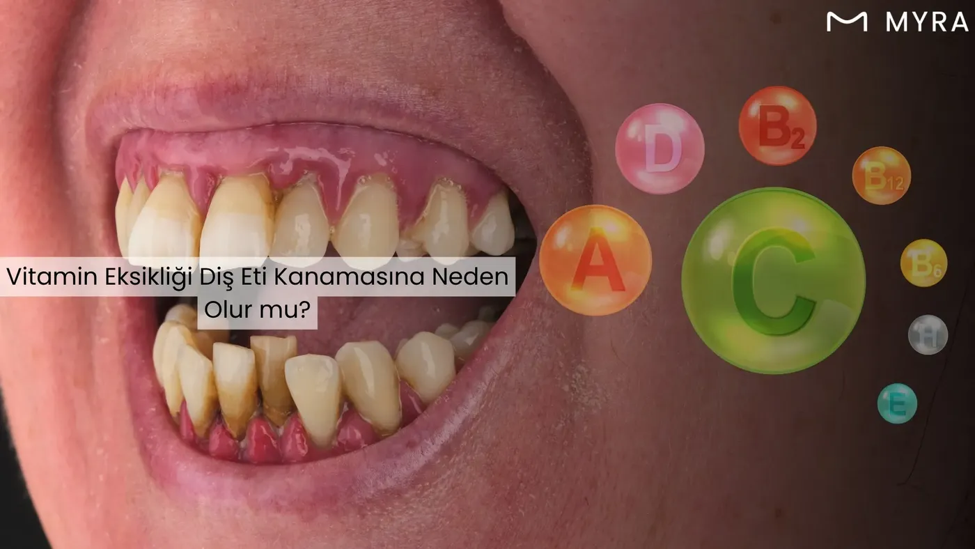 Diş eti kanaması hangi vitamin eksikliğinde olur