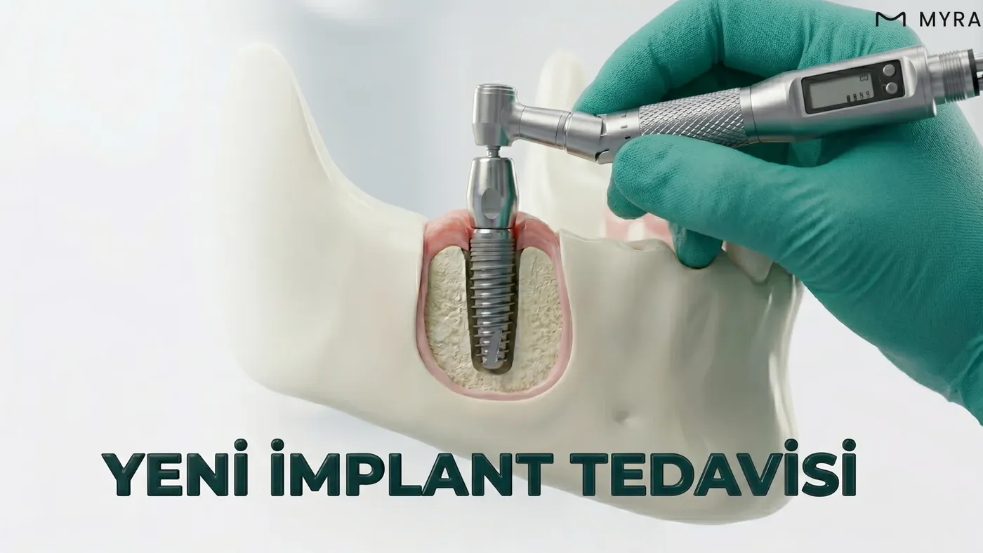 yeniden-implant.webp