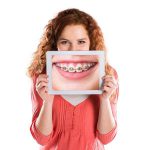 Ortodonti, Yetişkinlerde Ortodonti Tedavisi