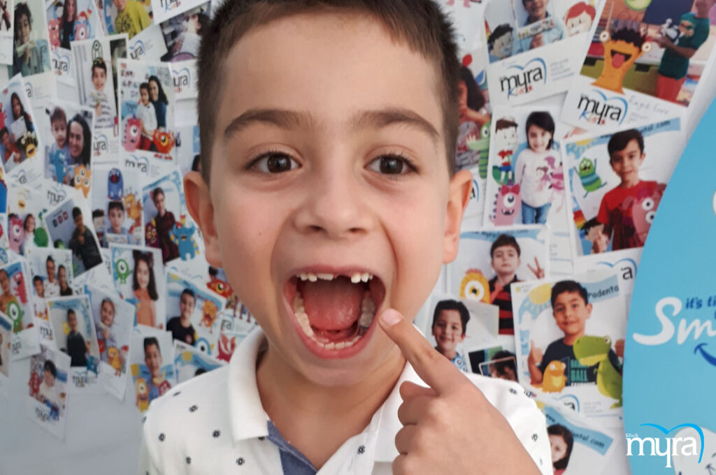 , Çocuklarda Diş Çekimi: Kalıcı Dişler ve Süt Dişi Çekimi ile İlgili Bilmeniz Gerekenler