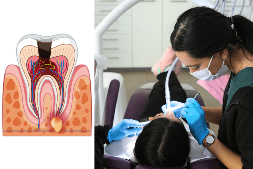 çocuk kanal tedavisi, Çocuklarda Diş Kanal Tedavisi